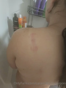 Chaoticintent bit me