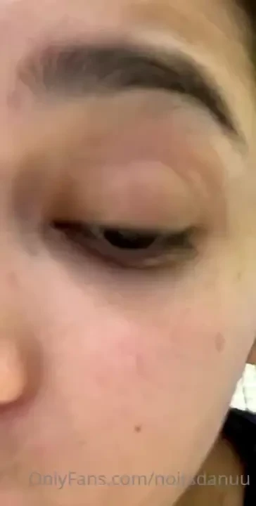 Anyone have an ointment fetish lol part 1 