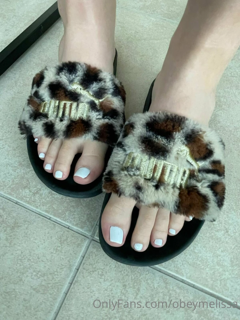 Fresh pedicure swipe to see amp close up then send to cover it 