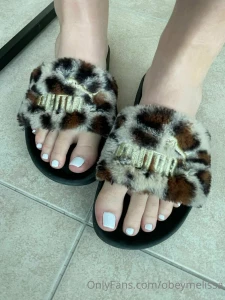 Fresh pedicure swipe to see amp close up then send to cover it