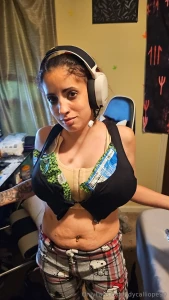 This healing process sucks lol