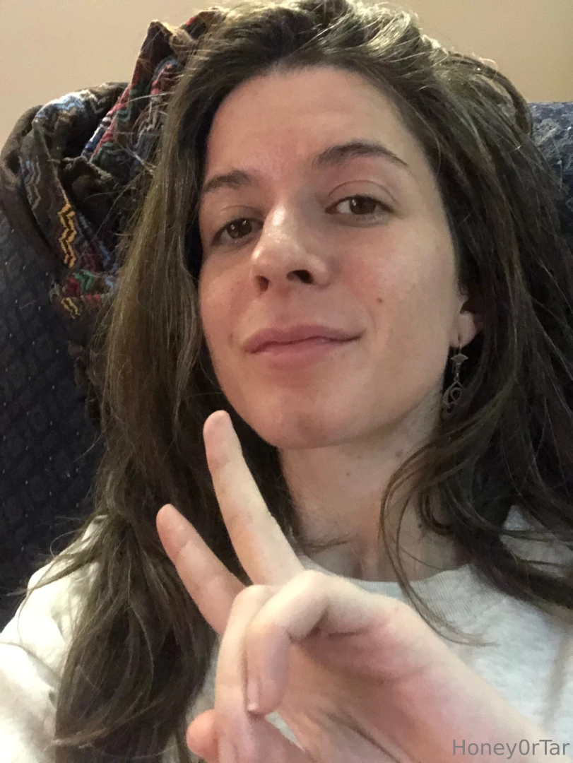 So about 3 weeks ago i started tretinoid for my acne acne scars and i 