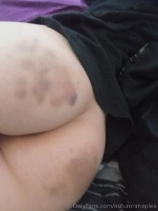 Who doesn t enjoy a marked up butt