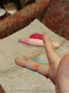 I fucked myself so hard i gave myself a blister will you kiss it daddy