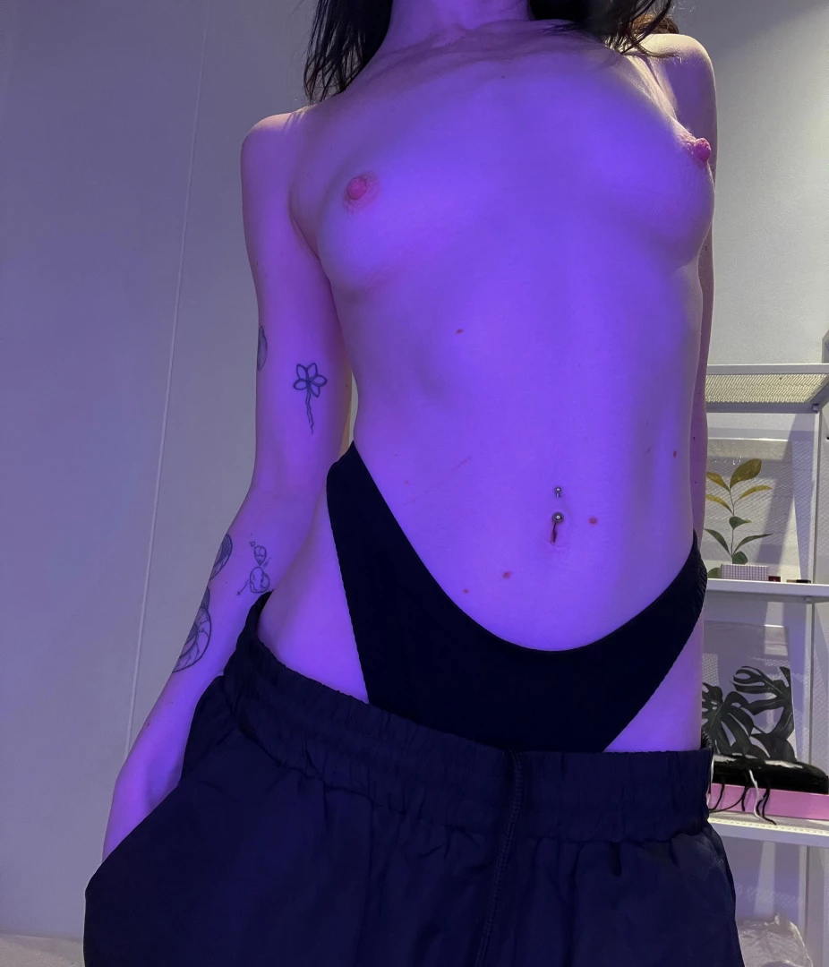 Peep the cat scratch on my tummy 