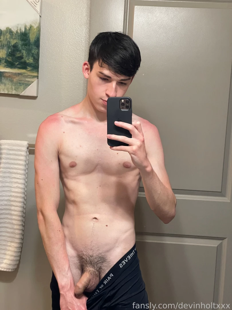 Been spending a lot of time outdoors lately got a little sun burned 