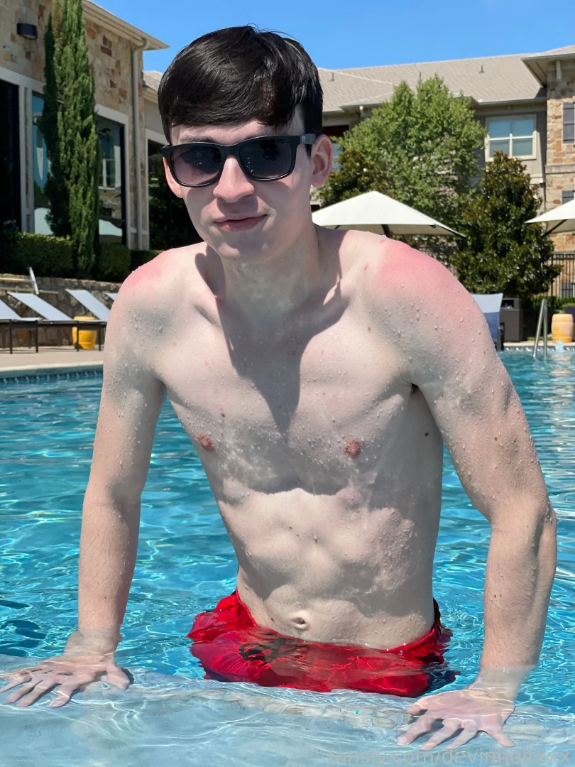 Been spending a lot of time outdoors lately got a little sun burned part 1 