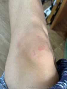 I m very sad because lately i ve been getting sick a lot as soon as i part 1