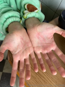 I m very sad because lately i ve been getting sick a lot as soon as i part 4