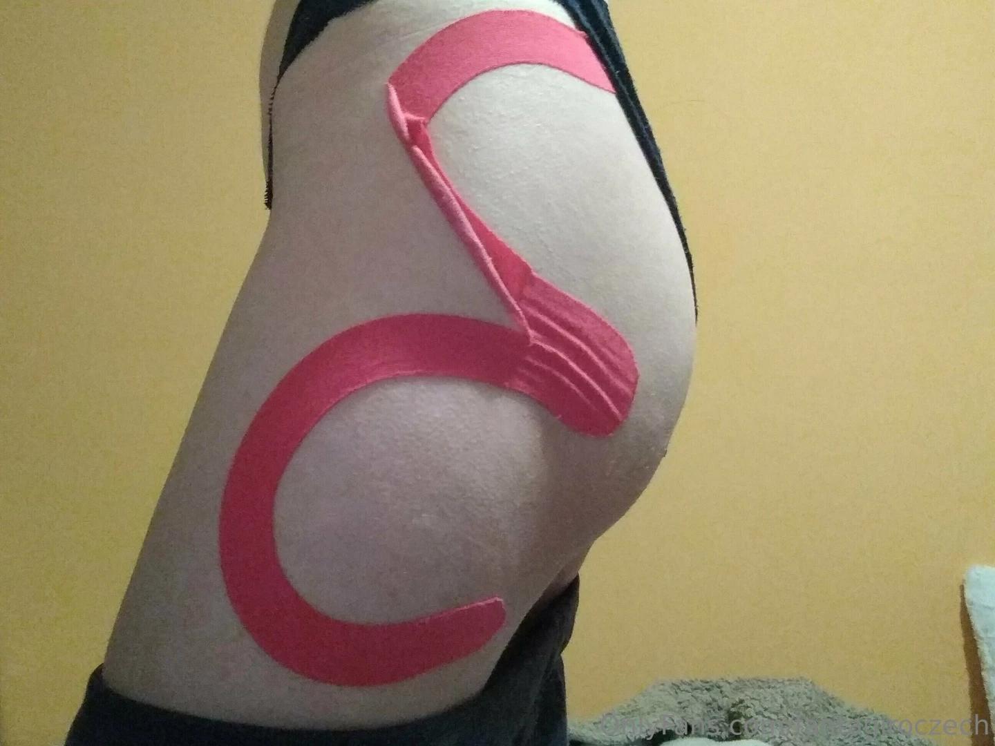 I love hiking but in may something happened so i had tapes on muscles 