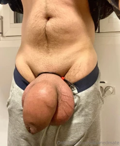 It s crazy to see how my junk has changed in just 7 months these pics part 1