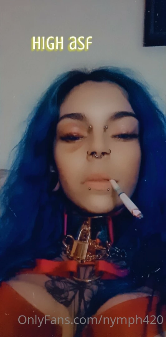 How sexy is my black eye lmao 