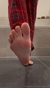 I just woke up this is how my feet look right after i got out of bed