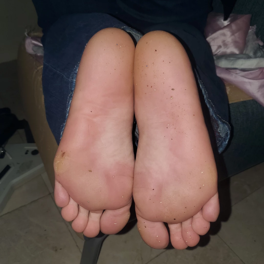 30 minutes ago this is the condition my feet are in directly out of 