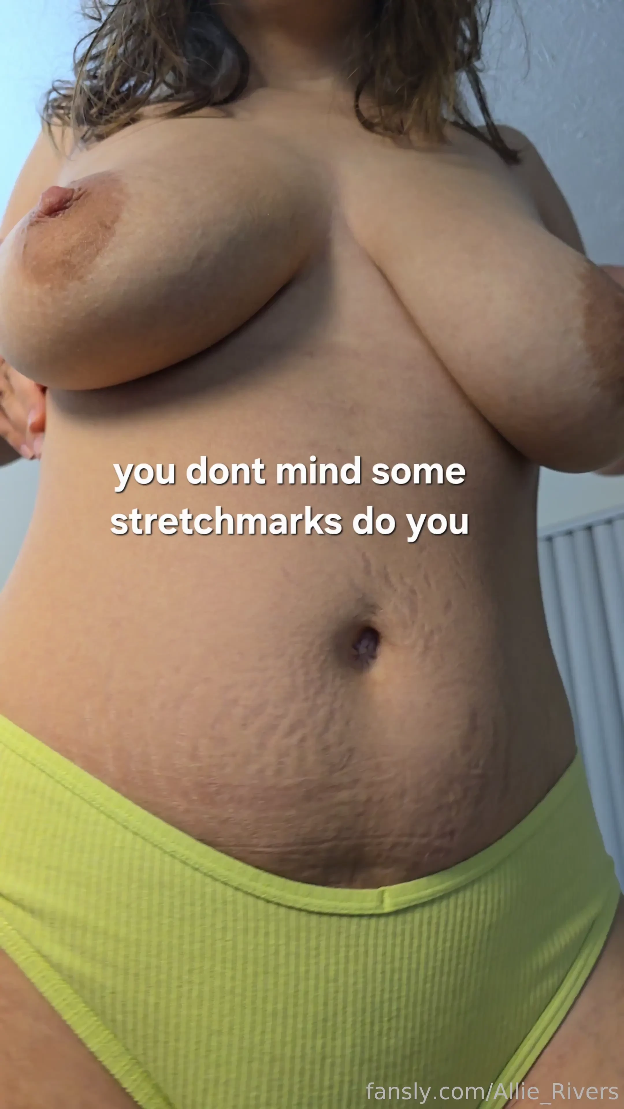 They showed up one day and have never left stretchmarks milf mommy 