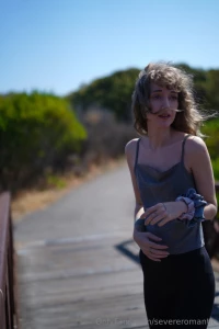 Feeling hella fucking old looking help me pay for botox please i m part 11