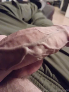 He needs alot of fluids