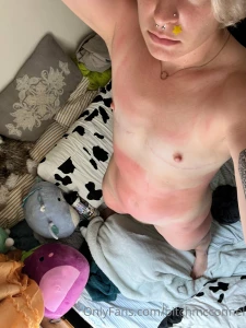 Saurrrrre babies i have bad news i have the actual worst sunburn in part 4