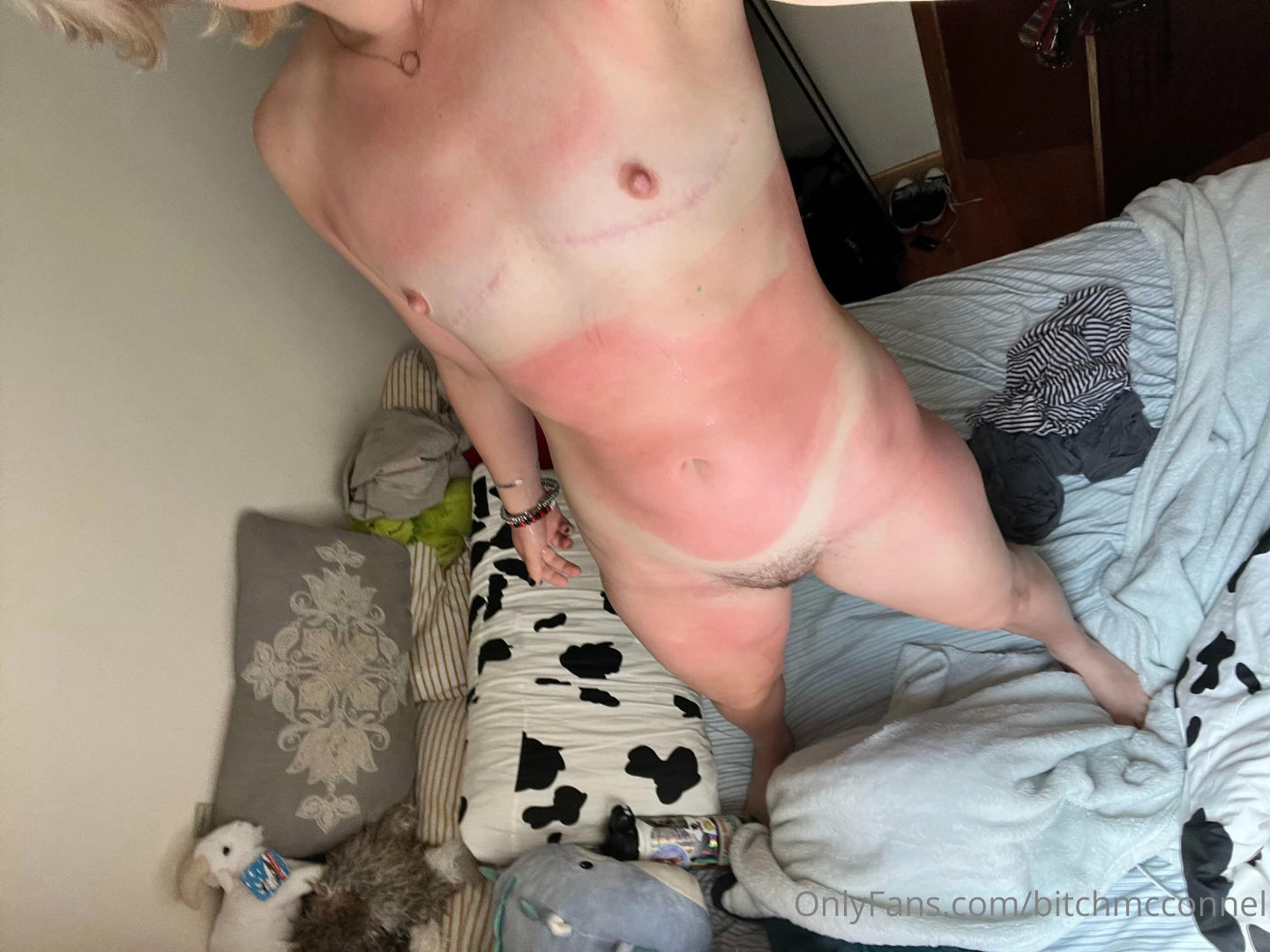 Saurrrrre babies i have bad news i have the actual worst sunburn in part 5 