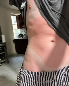 Saurrrrre babies i have bad news i have the actual worst sunburn in part 1