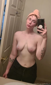 My chin has been so baaaaadddddd aghhghghhh