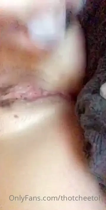 Pre surgery fun like a send off haha mmmm part 2 