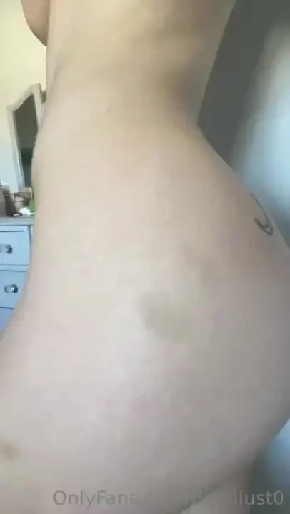 Can you guess how i got these bruises part 1 