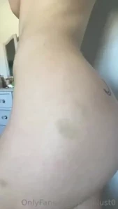 Can you guess how i got these bruises part 1