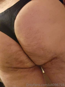 My hairy ass part 2