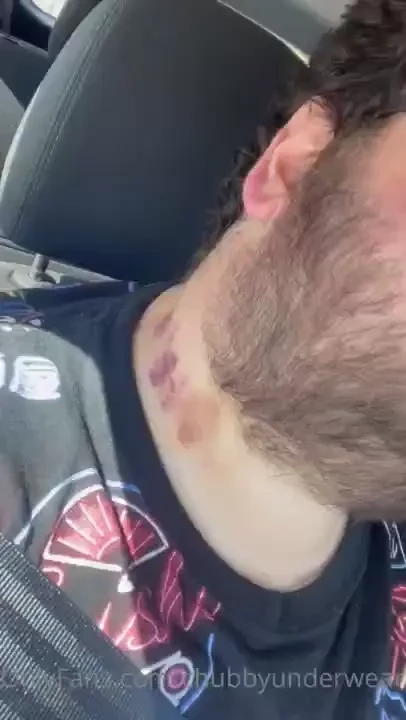 Tour de hickeys from last week at cannonball learned lesson for next 