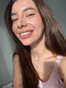 My braces were removed how do you like it part 1