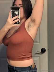 Here is a rope bruise i noticed looks kind of like a scratch right part 3