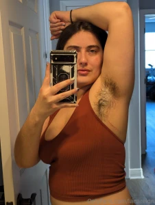 Here is a rope bruise i noticed looks kind of like a scratch right part 1