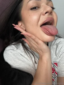 Yes i have all my natural teeth