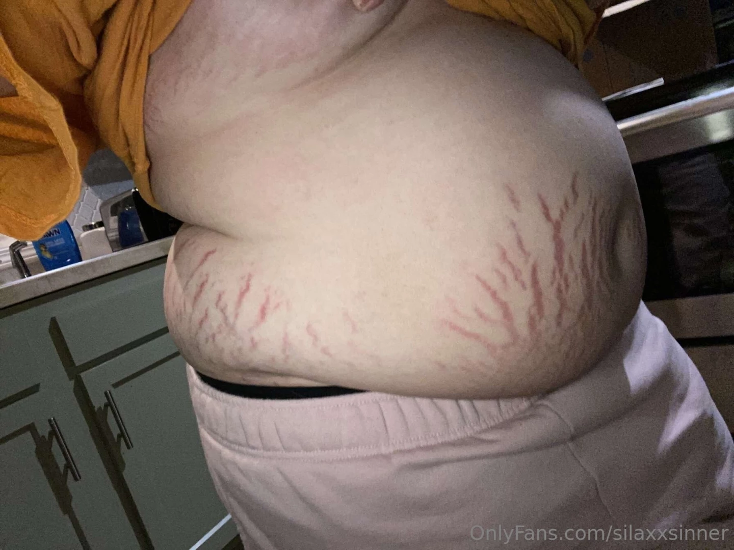 Absolutely covered in stretch marks all because of you 
