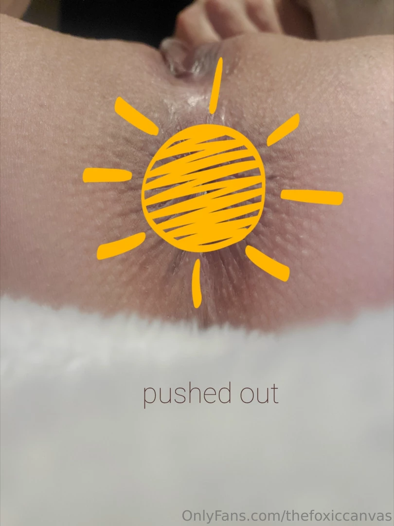 Sunshine post about my butt in all its different glory here is a 3 pic part 3 