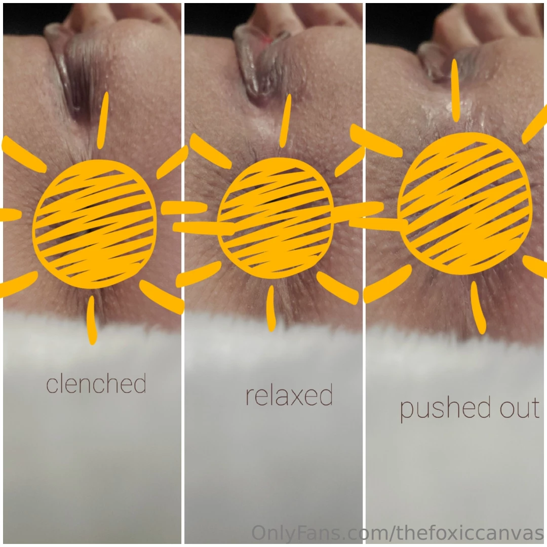 Sunshine post about my butt in all its different glory here is a 3 pic 