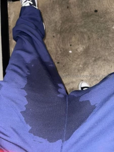 I spilled hot coffee in my lap and i m out working so not only did i