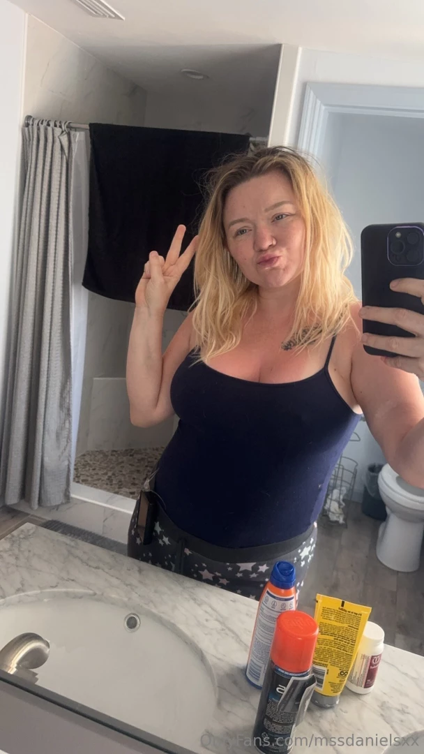 Update lol i m burned amp it hurts 