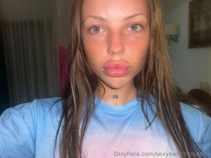 I got a little sunburned