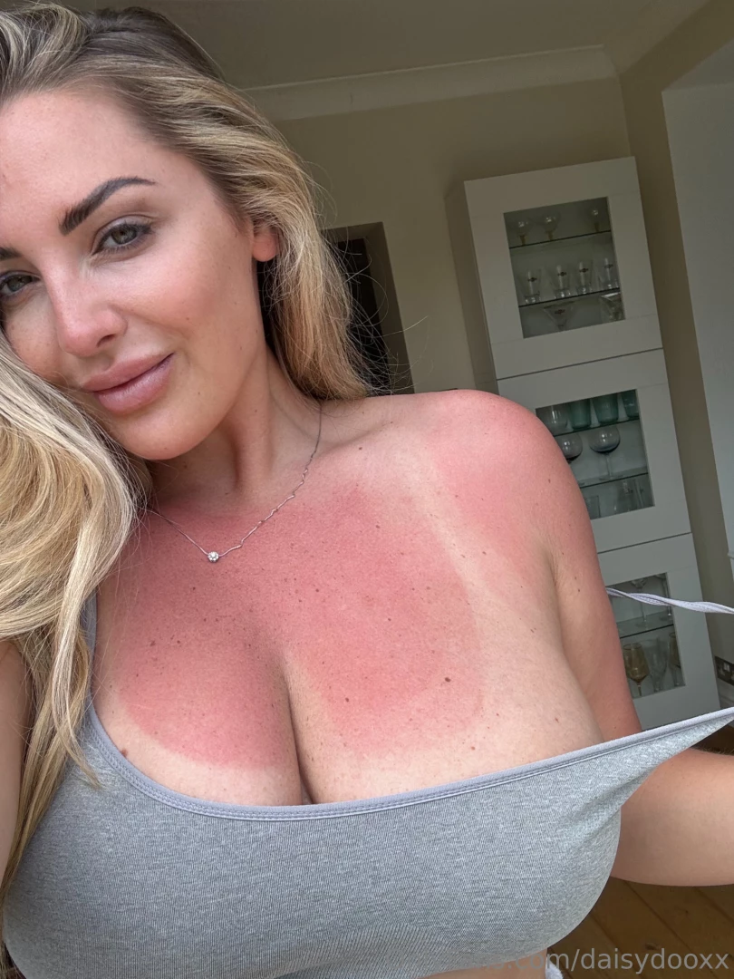 Wear your sun cream guys 