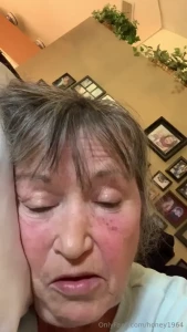 An update on my surgery