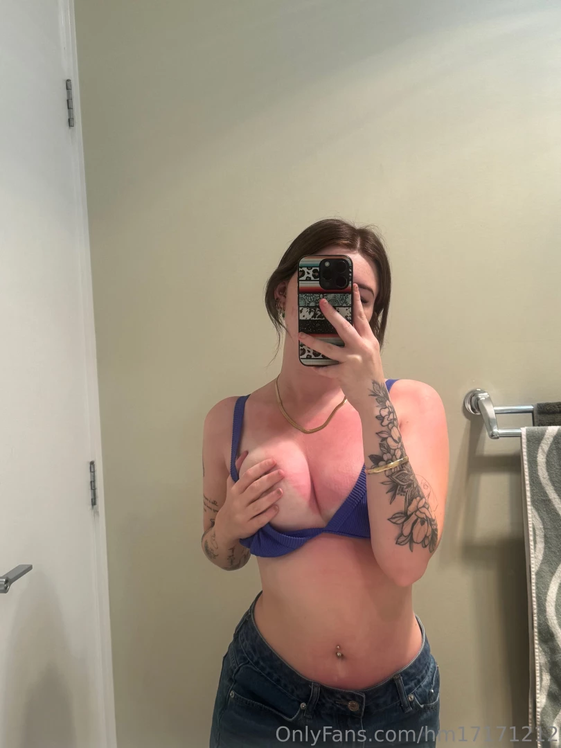 Babygirl is sunburnt 