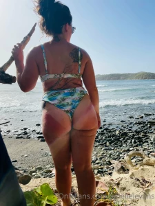 Last month my got burnt looks like i was spanked hard part 1