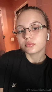 Do you think i should enlarge my lips