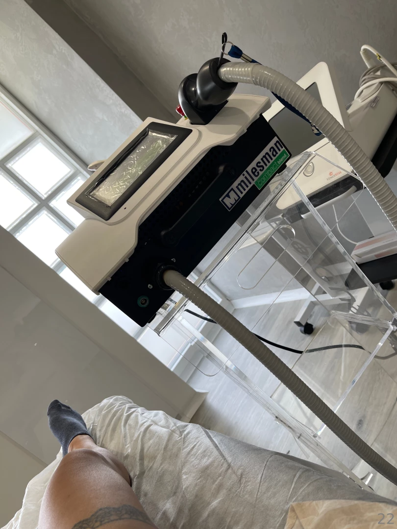 Laser hair removal part 1 