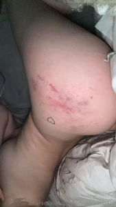 Got fucked so hard i got hand print bruises