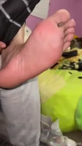 Ever wonder what my feet look like super sweaty they get calloused but