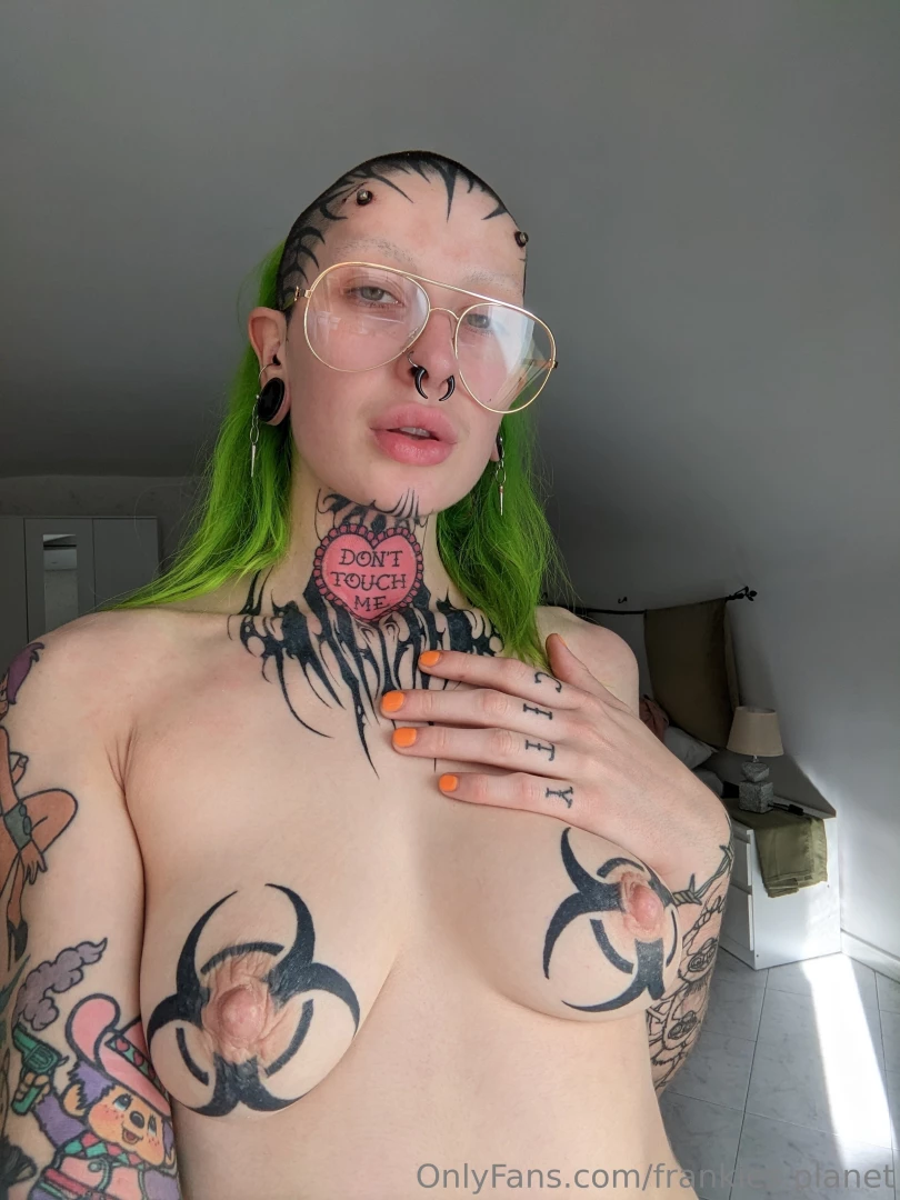 Got my transdermal implants done today in naples in around 6 months i 