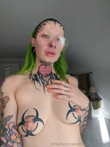 Got my transdermal implants done today in naples in around 6 months i